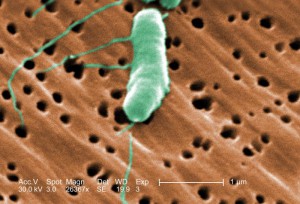 The rod-shaped bacterium known as Vibrio.  Courtesy: Florida International University