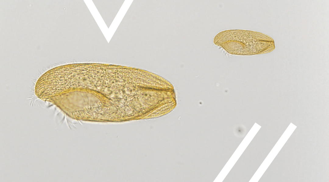 Marine Creatures of the Northern Gulf of Mexico – Ciliate Protozoans