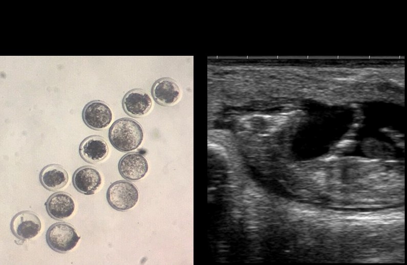 Fetal Versus Maternal Contributions of Bos indicus Genetics to Offspring Growth