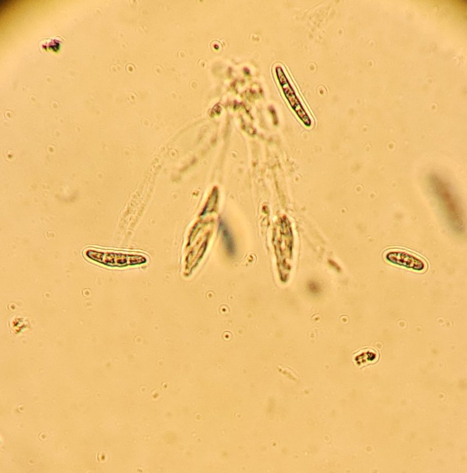 CBR spores